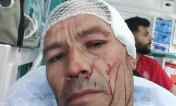 Alanya'da müdür vekili ile öğrenci veli kavgası kan gölüne döndü